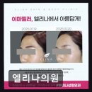 엘리나의원 네이버블로그