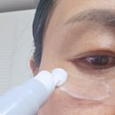 광재 | 가로목주름 세로목주름부터 팔자 눈밑주름까지 이퀄로지 목주름관리법 후기