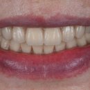 이바른치과기공소 이미지