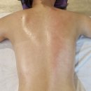 선샤인스킨케어 | 보라매 피부관리 선샤인스킨케어 등관리 후기 | 보라매 에스테틱 추천