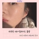 제너리스의원 | 다산 제너리스의원➰리쥬란HB+릴리이드 물광주사 내돈내산 후기