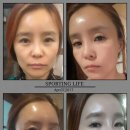 인셀덤_오드리