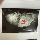 유한회사 메디마트 | 임신 7주차에서 10주차 초음파 입덧, 엘르메디 난임병원 졸업, 라움산부인과 전원