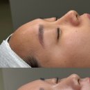리뮤즈(limuse) 네이버블로그