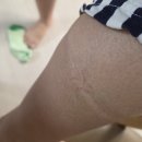 오금역 2번출구 후면 | 아인애비뉴 림프 부종 프라이빗 관리 청담위드뷰티주안 추천 후기