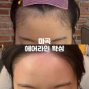 결혼준비 제이미왁싱 헤어라인 후기 마곡왁싱