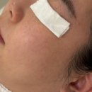 문화원로47번길 | 봉명동여드름압출 르올에스테틱에서 관리받고 피부 개선 후기