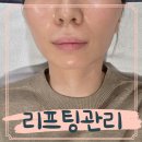 포마 | 마곡피부관리 리프팅 제네시스 인모드포마 FX 솔직후기