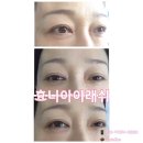 효니아이래쉬 | 효니아이래쉬-아이라인