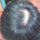 이로운약국 | 판시딜180정가격