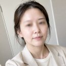 차이 | 울쎄라 600샷 300샷 차이 효과 후기