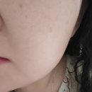 코스모과학 | 닥터코스모 엠엘크림 재생효과 일주일 사용 후 달라진 피부 변화 후기