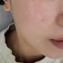 올먼트 | 연산동 에스테틱 추천｜리제이에스테틱 세멘부스팅먼트 후기