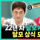 전지적 참견시점 스페셜 22년 차 탈모계 권위자의 탈모 상식 모음 영상 이미지