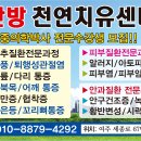 BRT 마사지의 놀라운 능력. 이미지