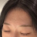 그린옵티마약국 | [내돈내산] 헤브블루 신제품 더마징크앰플 후기; 옵티마약국 콜라보 앰플, 유분 폭발 수부지 피부는 보세요