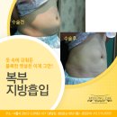 바디명작 이미지