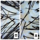 뷰티인독 | [경남/양산]양산 지루성두피·문제성두피 ‘청담뷰티센터‘ 관리 후기