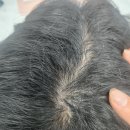 본기획 | 내가 사용해본 탈모샴푸 순위 1위 성사기획 엘릭 솔직 후기