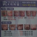 이천문제성발전문#라파엘 이미지