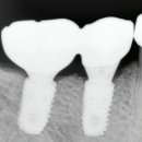 당산수치과의원 이미지