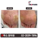 레푸스 망우점