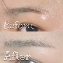 눈썹달 | 천호동 미작뷰티 강동점 눈썹문신 제거 눈문 한달 후기