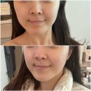 차옴테라피 네이버블로그