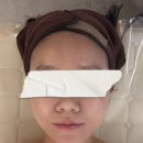 엘22 | 광명피부관리 뷰티더엘 리프팅 수분관리 후기