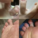 원스메디 네이버블로그