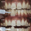 서울뿌리치과의원 이미지