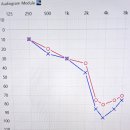 시그니아독일보청기관악센터