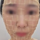 연세보드미의원 네이버블로그