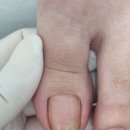 연향번영길 | 광양내성발톱 등 발관리 잘하는 곳 레푸스 순천연향점