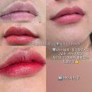 3966 | 대전입술리얼탈각후기, 20대언니분 입술문신 리얼후기(대전캐츠아이)