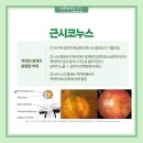 큰빛안과의원 이미지