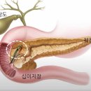 췌장암 환자의 갈등과 고민 ​ 이미지