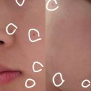 압구정에이블의원 이미지