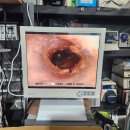 Olympus ENF-VQ Flexible Video Rhinolaryngoscope 이미지