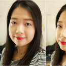 트레졸리 이미지