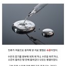 무시무시한 매독 치료법 이미지