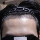 압구정모비앙의원 이미지