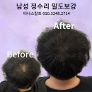 티나스칼프