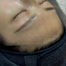 이니더왁싱 | 전포 왁싱 메이니뷰티 이마 + 헤어라인 왁싱 후기