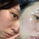 엘렉센 | 피부관리에 진심인 나.. 1개월 간의 피부 개선 과정과 결과물