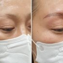 고은하늘성형외과의원 네이버블로그