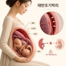 에스더중기 | 경기도광주산부인과 임신중출혈? 태반조기박리 신호일 수 있습니다