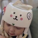 지오크리에이티브호남지사 | 아기 광주 두상교정 진료, 두상교정헬멧제작, 헬멧착용후기(광주기독병원, 지오크리에이티브호남지사)