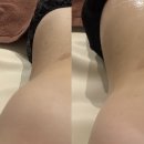강일여자고등학교 | [강릉다이어트] 에이알에프(ARF) 복부관리 후기