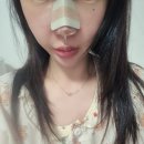 비아한의원 | 교대역 기능코 기능코 후기 비염수술 후기 1~ 3일차 까쥐